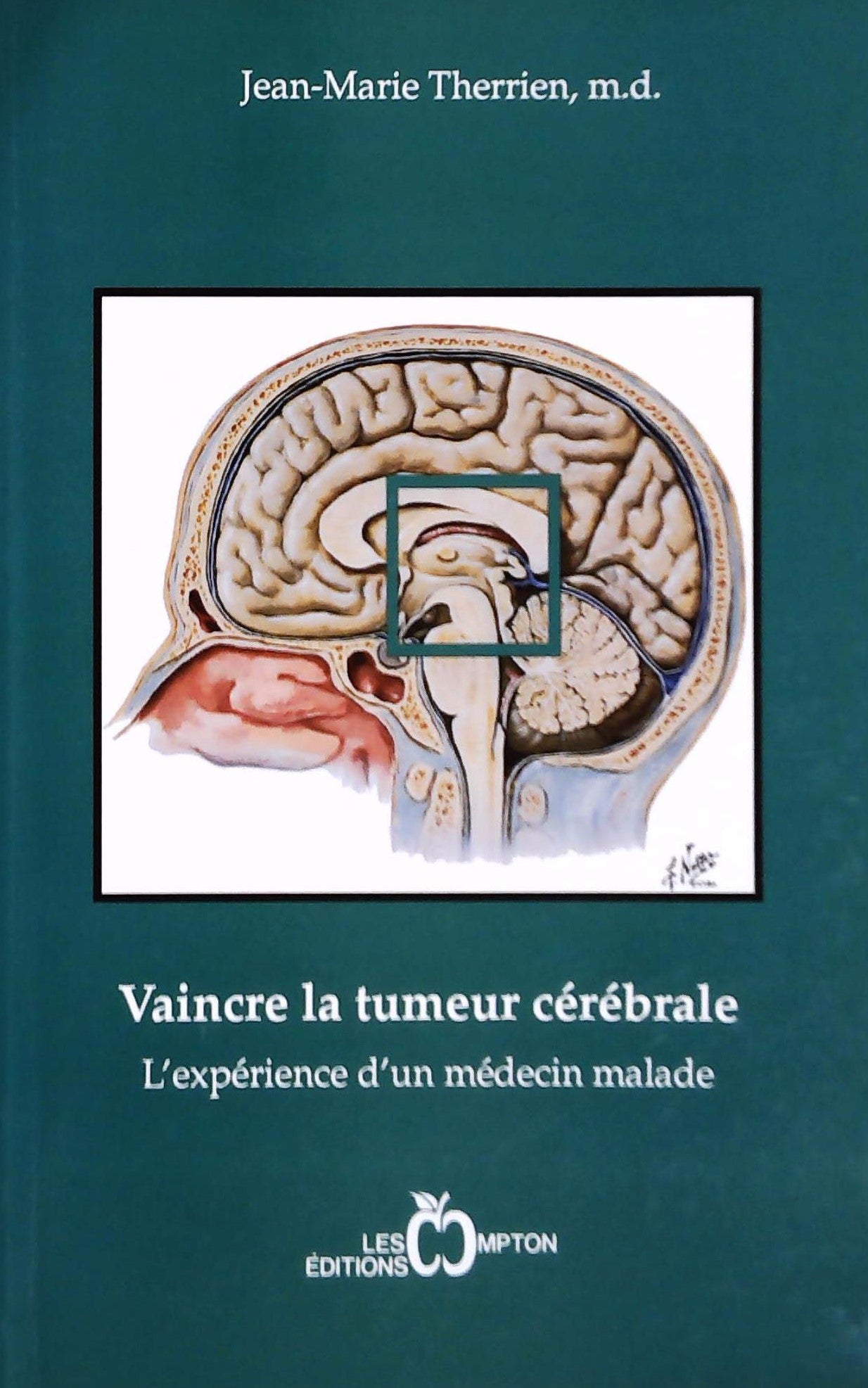Livre ISBN 292048219X Vaincre la tumeur cérébrale, l'expérience d'un médecin malade (Jean-Marie Therrien)