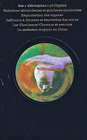 La parapsychologie : Les pouvoirs inconnus de l'homme : Les guérisseurs psi : Les chirurgiens philippins, guérisons miraculeuses et guérisons spotanées, régénération des organes, ….
