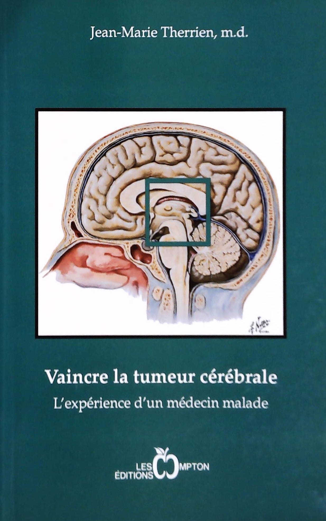 Livre Vaincre la tumeur cérébrale, l'expérience d'un médecin malade - Jean-Marie Therrien (Livre ...